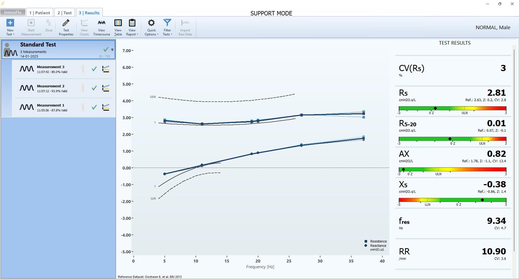 Tremoflo C2 04 Software
